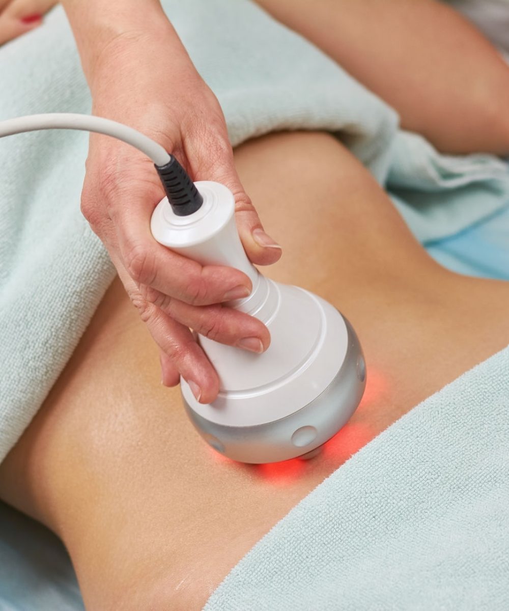 84800510 - radio frequency skin tightening machine. belly of a woman, cosmetology.